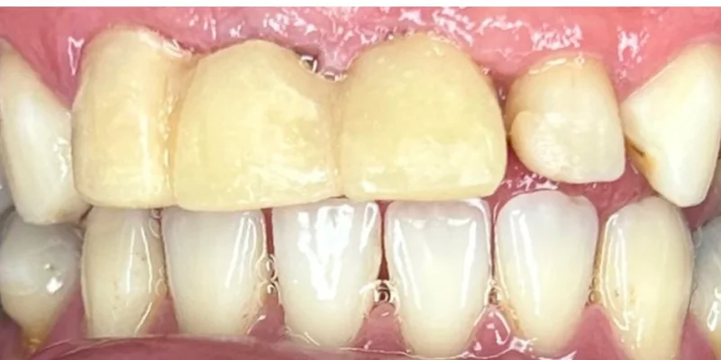 Estado inicial del paciente